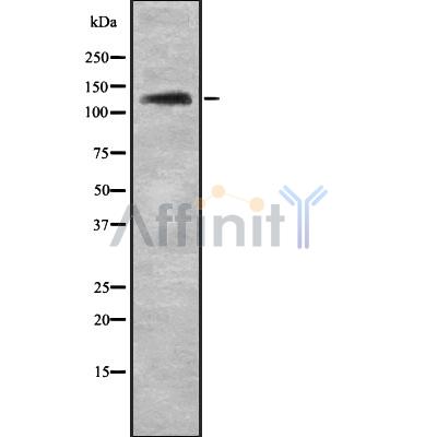 NOL8 Antibody - Western blot analysis NOL8 using HepG2 whole cell lysates.