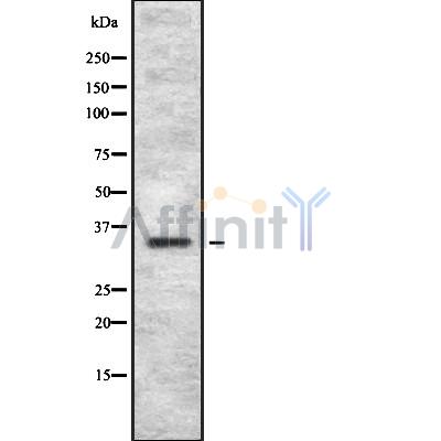 OR4C12 Antibody - Western blot analysis OR4C12 using HuvEc whole cell lysates.