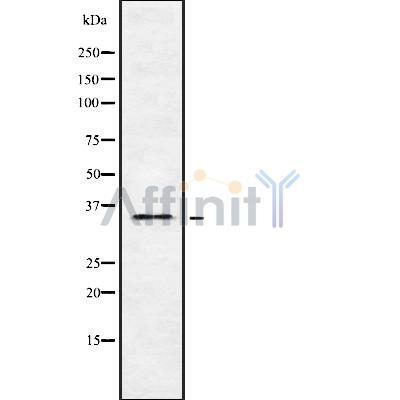 OR5H6 Antibody - Western blot analysis OR5H6 using Jurkat whole cell lysates.