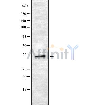 OR8B2/B3 Antibody - Western blot analysis OR8B2/B3 using LOVO whole cell lysates.