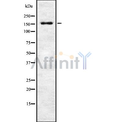 Phospho-MEKK1 (Thr1402)[Thr1400] Antibody - Western blot analysis of extracts from K562 cells, using Phospho-MAP3K1 (Thr1402) Antibody.