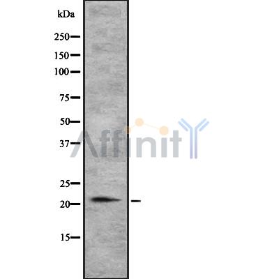 TGIF2LY Antibody - Western blot analysis of TGIF2LY using NIH-3T3 whole cell lysates.