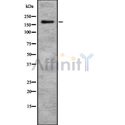 CHD1 Antibody - Western blot analysis of CHD1 using MCF7 whole cell lysates.