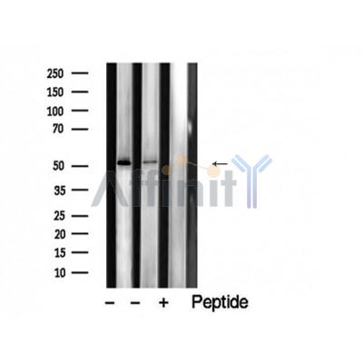 ZIC1/2/3/4/5 Antibody - Western blot analysis of extracts from various samples,using ZIC1/2/3/4/5 Antibody.