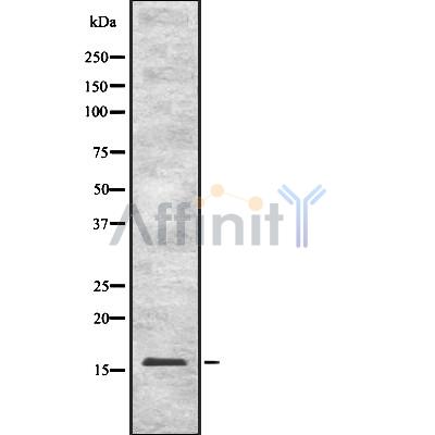 LDOC1 Antibody - Western blot analysis of LDOC1 using COLO205 whole cell lysates.