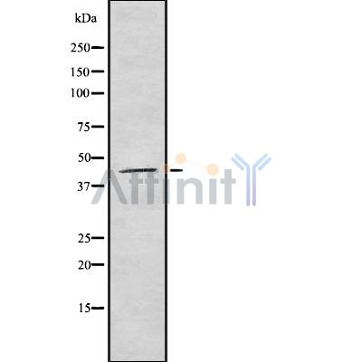 KR1_VZVD Antibody - Western blot analysis of KR1_VZVD using mouse brain lysates.