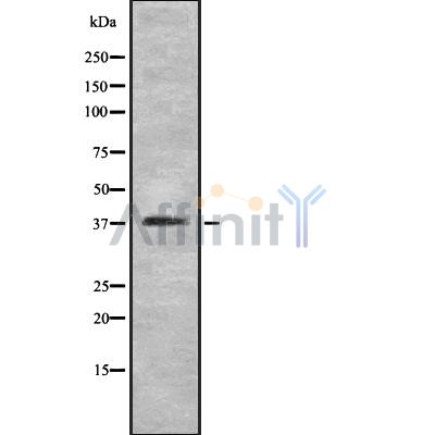 KITH_VZV7 Antibody - Western blot analysis of KITH_VZV7 using HeLa whole cell lysates.