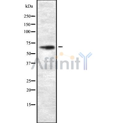 GCVK_HHV6U Antibody - Western blot analysis GCVK_HHV6U using A549 whole cell lysates.