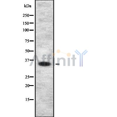 MAGEA9 Antibody - Western blot analysis of MAGEA9 using HuvEc whole cell lysates.