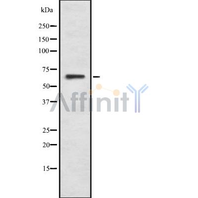 GCVK_HHV7J Antibody - Western blot analysis GCVK_HHV7J using K562 whole cell lysates.