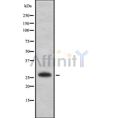 EMX2 Antibody - Western blot analysis of EMX2 using K562 whole cell lysates.