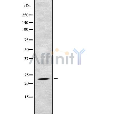 TAF10 Antibody - Western blot analysis of TAF10 using Jurkat whole cell lysates.