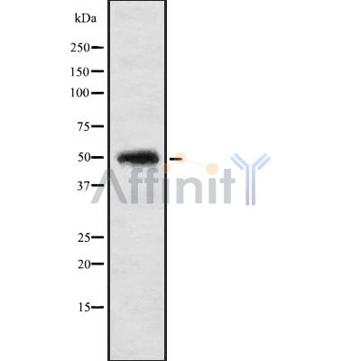IP6K1 Antibody - Western blot analysis IP6K1 using K562 whole cell lysates.