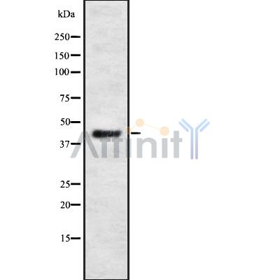 PSKH2 Antibody - Western blot analysis of PSKH2 using Jurkat whole cell lysates.