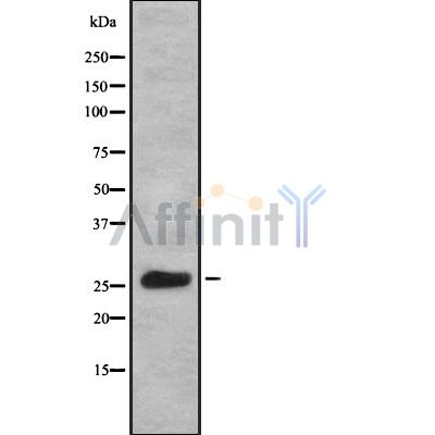 KCIP1 Antibody - Western blot analysis of KCIP1 using COLO205 whole cell lysates.