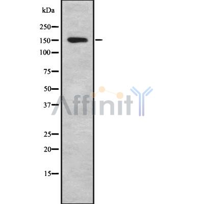 IBTK Antibody - Western blot analysis IBTK using Jurkat whole cell lysates.