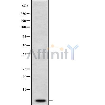 PKIG Antibody - Western blot analysis of PKIG using COLO205 whole cell lysates.
