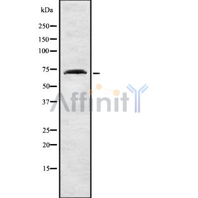 Collagen VIII  alpha 1 Antibody - Western blot analysis of Collagen VIII α1 using LOVO whole cell lysates.