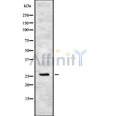 CIDEC Antibody - Western blot analysis of CIDEC using HeLa whole cell lysates.