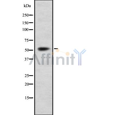 CDCA7L Antibody - Western blot analysis of CDCA7L using MCF7 whole cell lysates.