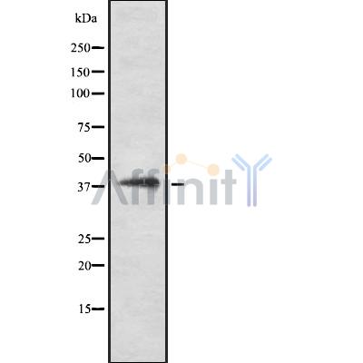 DNAJB5 Antibody - Western blot analysis of DNAJB5 using COLO205 whole cell lysates.