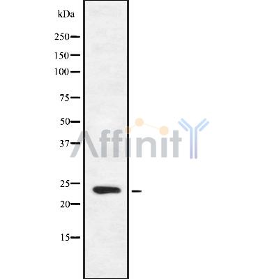 FGF16 Antibody - Western blot analysis FGF16 using HeLa whole cell lysates.