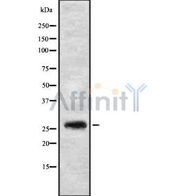 FGFBP3 Antibody - Western blot analysis FGFBP3 using HT29 whole cell lysates.