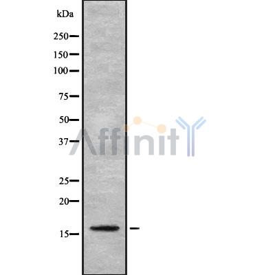 FKSG2 Antibody - Western blot analysis FKSG2 using HT29 whole cell lysates.