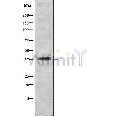 INGR2 Antibody - Western blot analysis INGR2 using HeLa whole cell lysates.