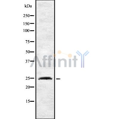 INSIG2 Antibody - Western blot analysis INSIG2 using HeLa whole cell lysates.