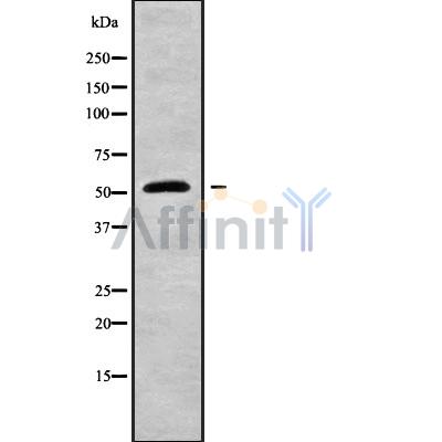KRT81 Antibody - Western blot analysis of KRT81 using COLO205 whole cell lysates.