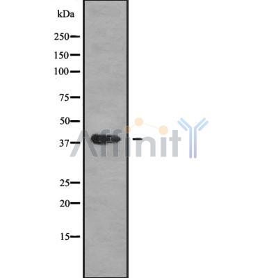 MAGEB1 Antibody - Western blot analysis of MAGB1 using HepG2 whole cell lysates.