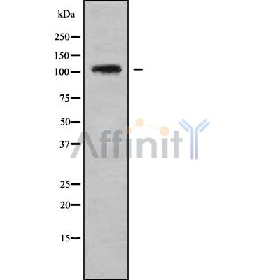 CENPC1 Antibody - Western blot analysis of CENPC1 using Jurkat whole cell lysates.