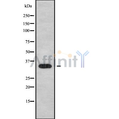 CENPP Antibody - Western blot analysis of CENPP using K562 whole cell lysates.