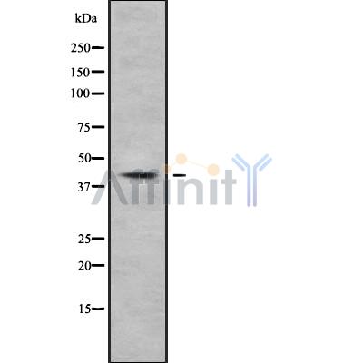 NFKBIL1 Antibody - Western blot analysis NFKBIL1 using HepG2 whole cell lysates.