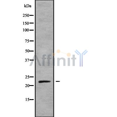 NKIRAS1 Antibody - Western blot analysis NKIRAS1 using mouse liver lysates.