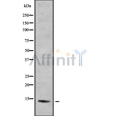MYCNOS Antibody - Western blot analysis of MYCNOS using K562 whole cell lysates.