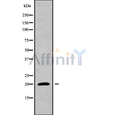 NIP7 Antibody - Western blot analysis NIP7 using LOVO whole cell lysates.