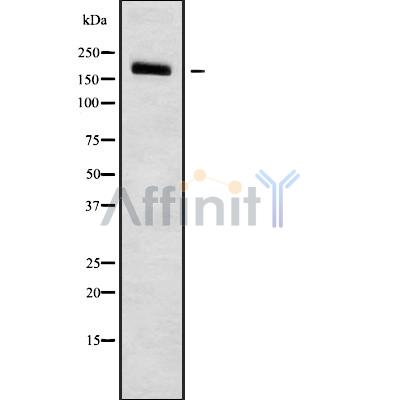 PDS5B Antibody - Western blot analysis of PDS5B using COLO205 whole cell lysates.