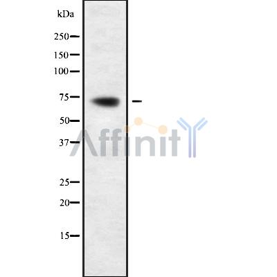 PIF1 Antibody - Western blot analysis of PIF1 using HepG2 whole cell lysates.