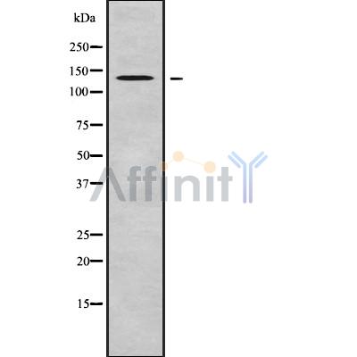 RECQL4 Antibody - Western blot analysis of RECQL4 using K562 whole cell lysates.