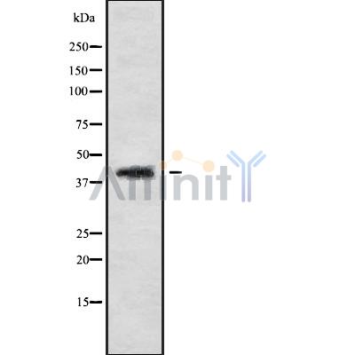 CABP1 Antibody - Western blot analysis of CABP1 using HepG2 whole cell lysates.