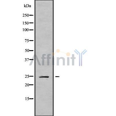 CABP2 Antibody - Western blot analysis of CABP2 using MCF7 whole cell lysates.