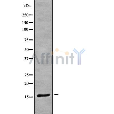 CRABP1 Antibody - Western blot analysis of CRABP1 using COLO205 whole cell lysates.