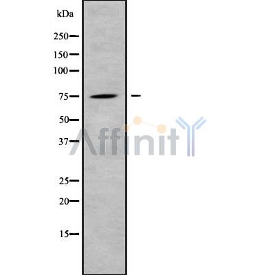 CLCNKB Antibody - Western blot analysis of CLCNKB using COLO205 whole cell lysates.