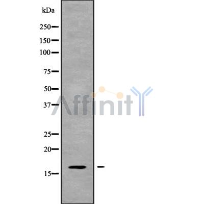 CST8 Antibody - Western blot analysis of CST8 using Jurkat whole cell lysates.