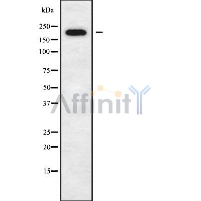 DOCK11 Antibody - Western blot analysis of DOCK11 using K562 whole cell lysates.
