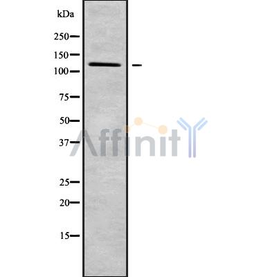 DSG4 Antibody - Western blot analysis of DSG4 using HeLa whole cell lysates.