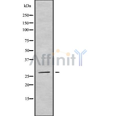 NSMCE2 Antibody - Western blot analysis NSMCE2 using LOVO whole cell lysates.