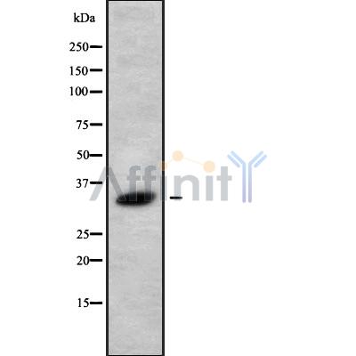 MARCH8 Antibody - Western blot analysis of MARCH8 using HuvEc whole cell lysates.